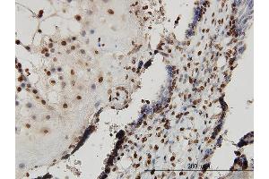 Immunoperoxidase of monoclonal antibody to SMAD7 on formalin-fixed paraffin-embedded human placenta. (SMAD7 Antikörper  (AA 160-260))