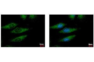 Immunofluorescence (IF) image for anti-Ionized Calcium-binding Adapter Molecule 1 (IBA1) antibody (ABIN2855067)