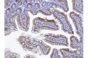 IHC analysis of TOX using anti-TOX antibody (ABIN7599443). (TOX Antikörper  (AA 1-495))