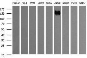 Image no. 2 for anti-CD163 (CD163) antibody (ABIN1497176)