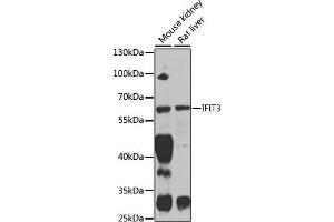 Western blot analysis of extracts of various cell lines, using IFIT3 antibody (ABIN1680389, ABIN3018293, ABIN3018295 and ABIN6220427) at 1:1000 dilution. (IFIT3 Antikörper  (AA 128-331))
