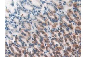 Immunohistochemistry (IHC) image for anti-Dihydrolipoamide Dehydrogenase (DLD) antibody (ABIN7442078)