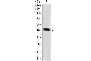 Western blot analysis using FGFR3 mAb against human FGFR3 (AA: 529-694) recombinant protein. (FGFR3 Antikörper  (AA 529-694))
