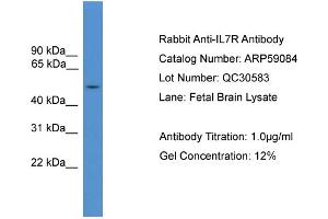 WB Suggested Anti-IL7R  Antibody Titration: 0. (IL7R Antikörper  (Middle Region))