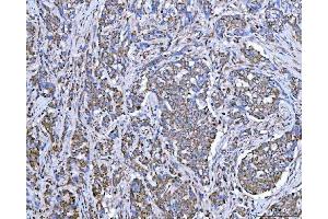 IHC analysis of SUCLG2 using anti-SUCLG2 antibody (ABIN7601694). (SUCLG2 Antikörper  (AA 42-424))