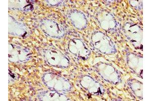 Immunohistochemistry of paraffin-embedded human colon tissue using ABIN7156649 at dilution of 1:100 (GBP1 Antikörper  (AA 383-592))