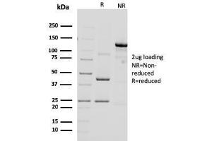SDS-PAGE Analysis Purified HER-2 Mouse Monoclonal Antibody (ERBB2/3092). (ErbB2/Her2 Antikörper  (AA 311-462))