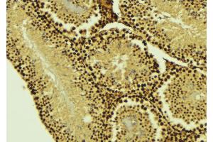 ABIN6274505 at 1/100 staining Mouse testis tissue by IHC-P. (XRN2 Antikörper  (N-Term))