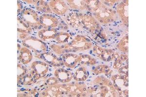 IHC-P analysis of kidney tissue, with DAB staining. (Complement Factor B Antikörper  (AA 35-160))