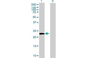 Western Blot analysis of ATG12 expression in transfected 293T cell line by ATG12 MaxPab polyclonal antibody. (ATG12 Antikörper  (AA 1-187))