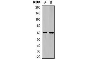 Western blot analysis of Ephrin B1/2 expression in HeLa (A), mouse hippocampus (B) whole cell lysates. (Ephrin B1 Antikörper  (C-Term))