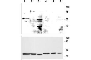 Western blot analysis of KCNK9 in rat cerebellum (lanes 1, 4), human mammary gland MCF-10A (lanes 2, 5) and MCF-7 (lanes 3, 6) cell lysates (upper panel):  - 1-3. (KCNK9 Antikörper  (Extracellular, P1 Loop))