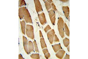 Forlin-fixed and paraffin-embedded hun skeletal muscle reacted with SD4 Antibody (C-term), which was peroxidase-conjugated to the secondary antibody, followed by DAB staining. (SMAD4 Antikörper  (C-Term))