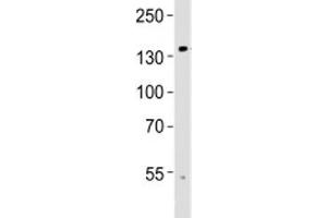 Western blot analysis of lysate from human brain tissue using TRPM8 antibody at 1:1000. (TRPM8 Antikörper  (AA 521-552))