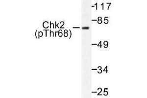 Image no. 1 for anti-Checkpoint Kinase 2 (CHEK2) (pThr68) antibody (ABIN317991) (CHEK2 Antikörper  (pThr68))