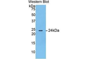 Western blot analysis of the recombinant protein. (Thymidine Phosphorylase Antikörper  (AA 38-247))
