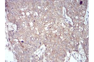 Immunohistochemistry (IHC) image for anti-NADPH Oxidase 4 (NOX4) (AA 210-310) antibody (ABIN5872374) (NADPH Oxidase 4 Antikörper  (AA 210-310))