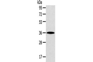 Western Blotting (WB) image for anti-Homeobox D13 (HOXD13) antibody (ABIN5961464) (Homeobox D13 Antikörper)