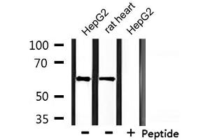 Western blot analysis of extracts from HepG2 and rat heart, using CLCC1 Antibody. (CLCC1 Antikörper  (Internal Region))