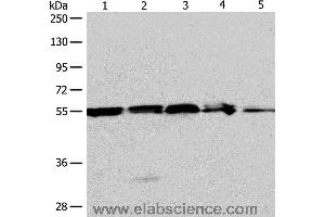 Western blot analysis of A375, 293T cell and mouse liver tissue, Jurkat cell and human fetal kidney tissue, using NAMPT Polyclonal Antibody at dilution of 1:700 (NAMPT Antikörper)