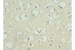 Immunohistochemistry (IHC) image for anti-Potassium Voltage-Gated Channel, Subfamily H (Eag-Related), Member 1 (KCNH1) (AA 840-989) antibody (ABIN7163991)
