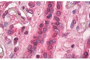 Human Placenta: Formalin-Fixed, Paraffin-Embedded (FFPE) (TGM1 Antikörper)