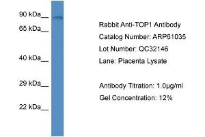 Western Blotting (WB) image for anti-Topoisomerase (DNA) I (TOP1) (N-Term) antibody (ABIN2788658) (Topoisomerase I Antikörper  (N-Term))