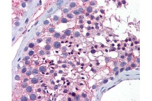 Immunohistochemistry (IHC) image for anti-Wingless-Type MMTV Integration Site Family, Member 10A (WNT10A) (AA 101-150) antibody (ABIN6747192)