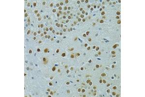 Immunohistochemistry of paraffin-embedded mouse brain using MUS81 antibody (ABIN6132372, ABIN6144202, ABIN6144203 and ABIN6222560) at dilution of 1:100 (40x lens). (MUS81 Antikörper  (AA 1-350))