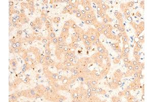 Immunohistochemistry (IHC) image for anti-Transforming Growth Factor, beta 1 (TGFB1) (C-Term) antibody (ABIN6266431)