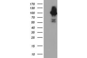 HEK293T cells were transfected with the pCMV6-ENTRY control (Left lane) or pCMV6-ENTRY C1S (Right lane) cDNA for 48 hrs and lysed. (C1S Antikörper)