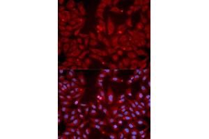 Immunofluorescence analysis of U2OS cell using GRIK2 antibody. (GRIK2 Antikörper  (AA 30-300))