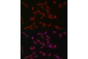 Immunofluorescence (IF) image for anti-Suppressor of Cytokine Signaling 1 (SOCS1) (AA 1-211) antibody (ABIN6148263)