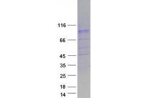 Validation with Western Blot