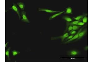 Immunofluorescence of purified MaxPab antibody to PLA2G16 on HeLa cell. (PLA2G16 Antikörper  (AA 1-162))