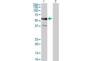 Western Blot analysis of MYC expression in transfected 293T cell line by MYC monoclonal antibody (M02), clone 1G7.
