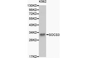 Western blot analysis of K562 cell lysate using SOCS3 antibody. (SOCS3 Antikörper  (C-Term))