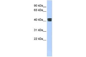 Western Blotting (WB) image for anti-Calcium Channel, Voltage-Dependent, beta 3 Subunit (CACNB3) antibody (ABIN2458122) (CACNB3 Antikörper)