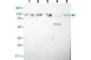 Western blot analysis of Lane 1: RT-4, Lane 2: EFO-21, Lane 3: A-431, Lane 4: Liver, Lane 5: Tonsil with SMEK2 polyclonal antibody  at 1:250-1:500 dilution. (SMEK2 Antikörper)