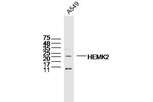 A549 lysates probed with HEMK2 Polyclonal Antibody, Unconjugated  at 1:300 dilution and 4˚C overnight incubation. (N6AMT1 Antikörper  (AA 1-100))