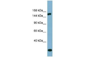 WB Suggested Anti-EPRS Antibody Titration:  0.