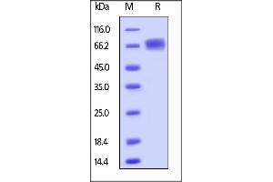 SDS-PAGE (SDS) image for Leukocyte Immunoglobulin-Like Receptor B3 (LILRB3) (AA 24-443) protein (His tag) (ABIN6253710)