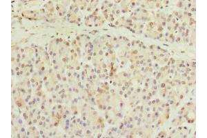 Immunohistochemistry of paraffin-embedded human pancreatic tissue using ABIN7148076 at dilution of 1:100 (CCDC116 Antikörper  (AA 1-300))