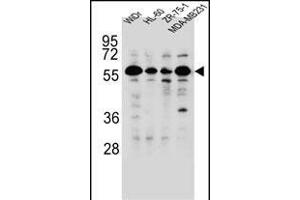 FOXC2 Antibody (Center ) (ABIN655526 and ABIN2845039) western blot analysis in WiDr,HL-60,ZR-75-1,MDA-M cell line lysates (35 μg/lane). (FOXC2 Antikörper  (AA 183-210))