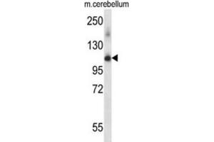 Western Blotting (WB) image for anti-Serine/threonine-Protein Kinase PRP4 Homolog (PRPF4B) antibody (ABIN2997999) (PRPF4B Antikörper)