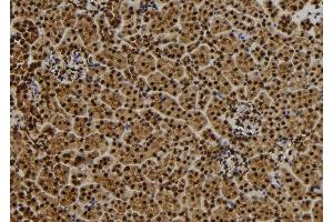ABIN6279445 at 1/100 staining Mouse kidney tissue by IHC-P. (QSER1 Antikörper  (Internal Region))