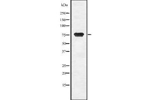 Western blot analysis of CGB using COS7 whole  lysates. (CGB Antikörper)