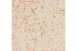 Immunohistochemistry (IHC) image for anti-Potassium Voltage-Gated Channel, Shab-Related Subfamily, Member 1 (KCNB1) (AA 687-858) antibody (ABIN3043866)