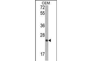 Western blot analysis of TIMP1 Antibody in CEM cell line lysates (35ug/lane) (TIMP1 Antikörper  (N-Term))