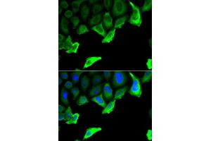 Immunofluorescence analysis of A549 cell using HSP90AA1 antibody. (HSP90AA1 Antikörper  (AA 433-732))